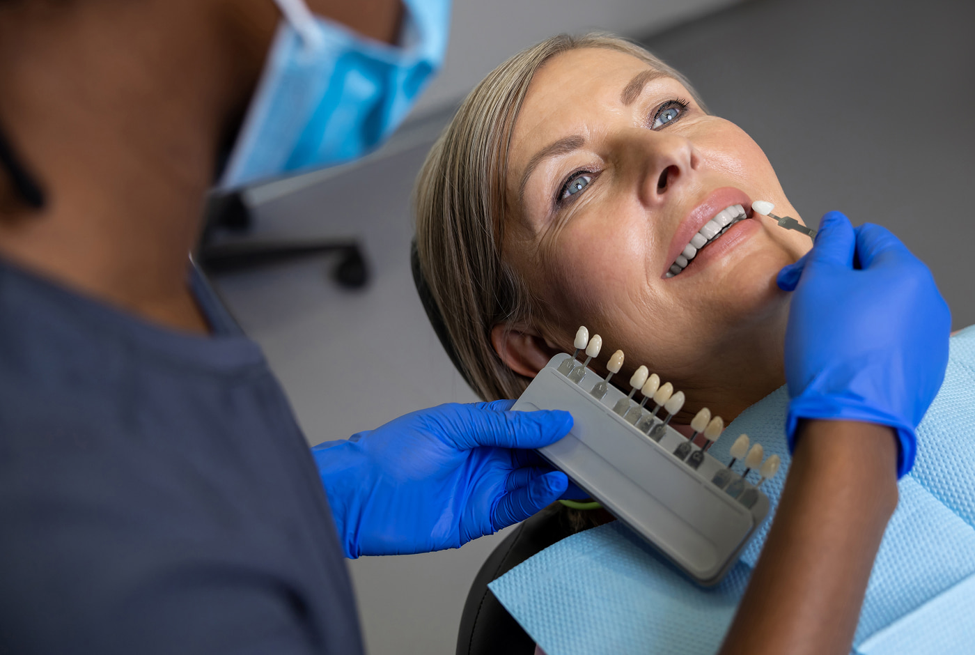 Ideal candidates for no-prep veneers with minor cosmetic concerns