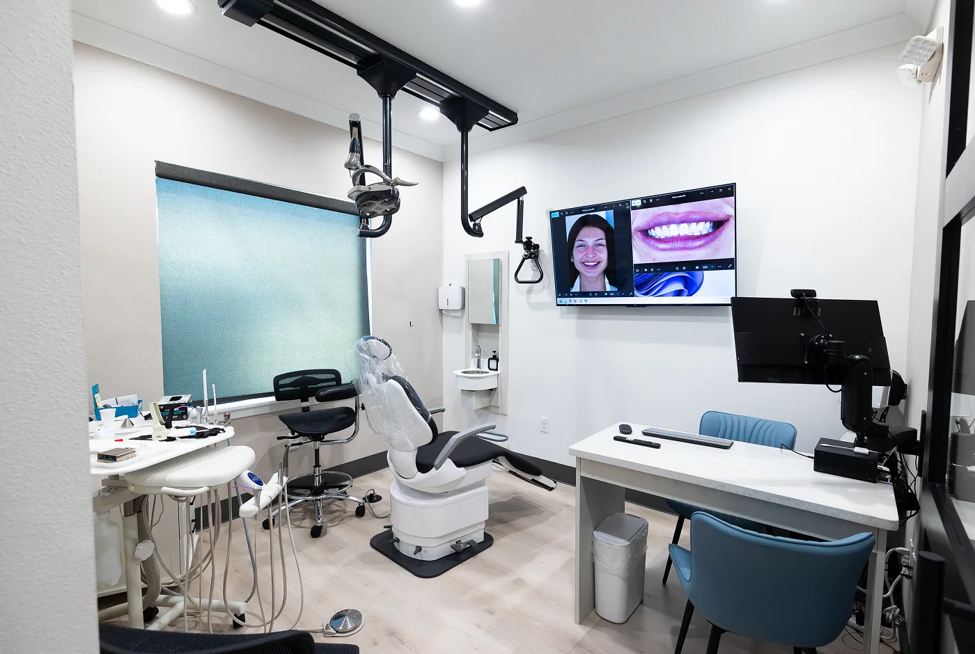 Ultra-thin no-prep porcelain veneers that require little to no enamel removal